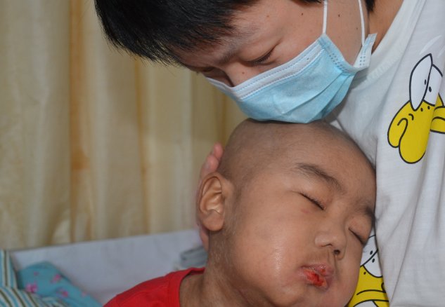 爷爷给2岁孙子针扎放血治抽搐,家长得做法正确与否?