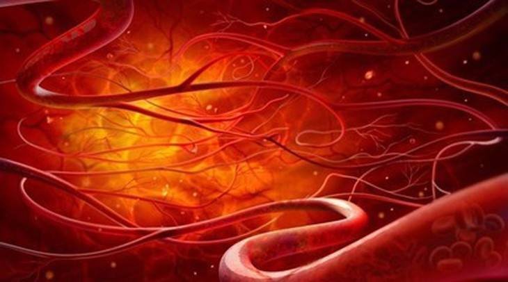 毛细血管瘤是什么