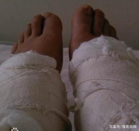 曾花400万整容200次，被称第一狂人的红粉宝宝，现今如何？