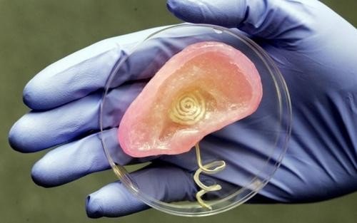 3d打印涉及的医学领域有哪些?