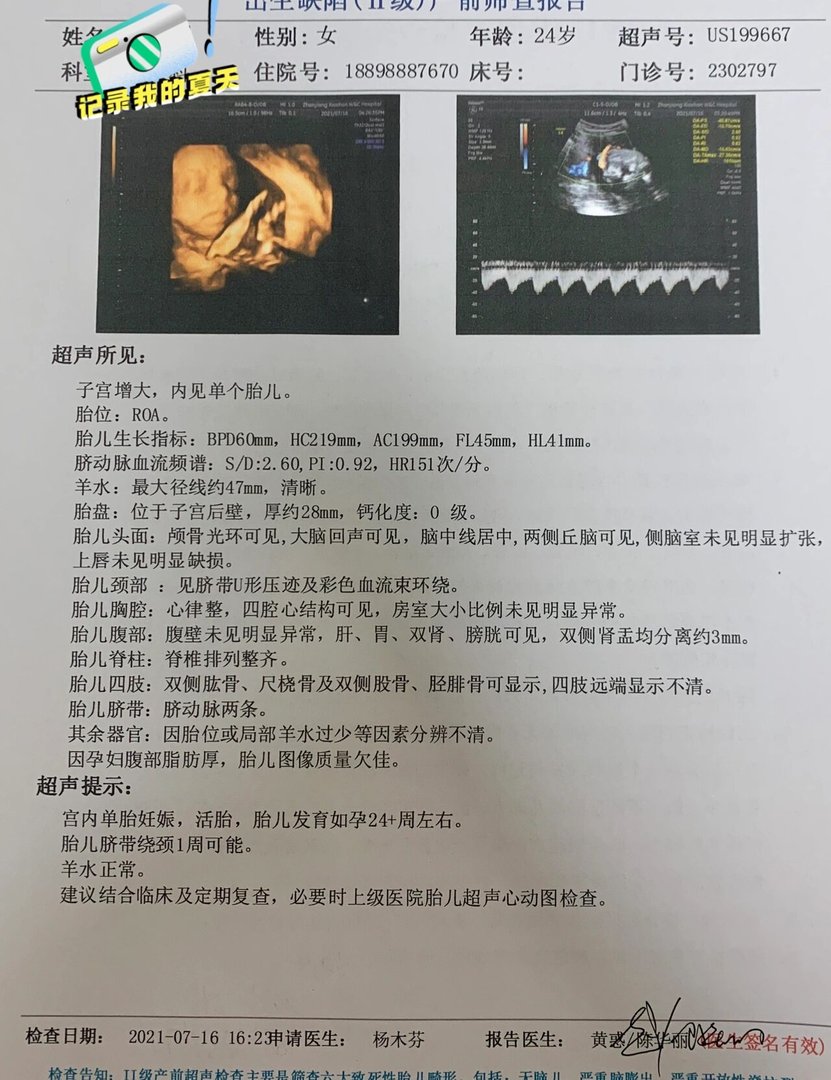 孕妇糖耐量检查多少周去最合适