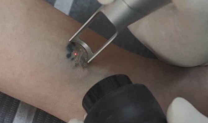 洗纹身很疼吗？