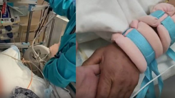 老人住ICU，独子被困西安无法照顾，老人需签字做手术时医生是怎么做的？