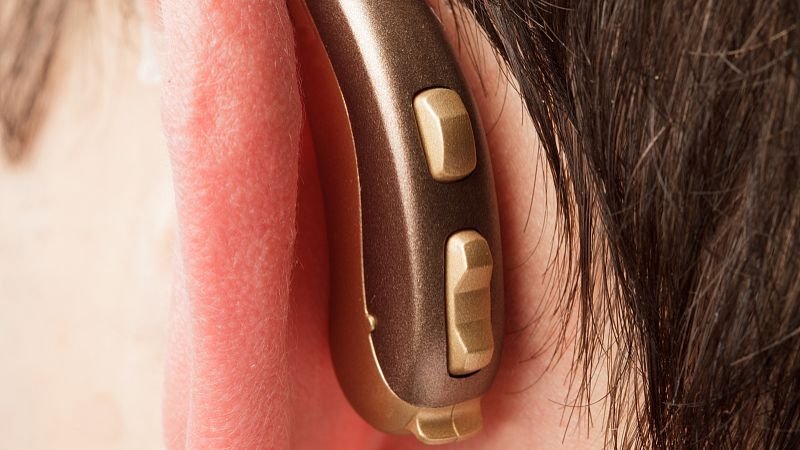 欧仕达助听器质量如何？