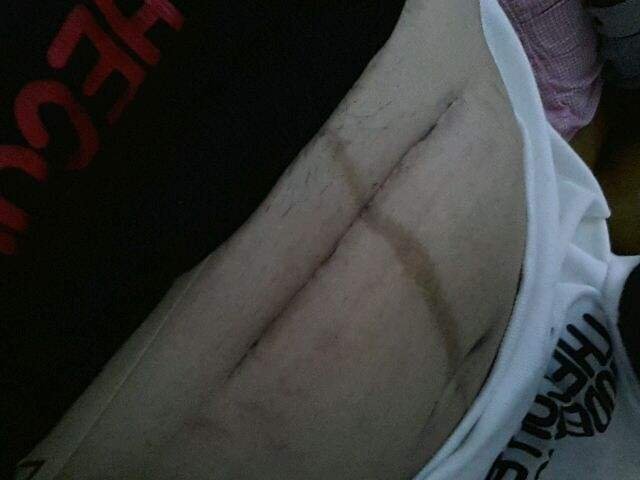 人为什么会有腹中线？