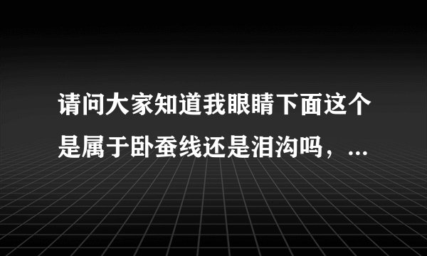 请问大家知道我眼睛下面这个是属于卧蚕线还是泪沟吗，好迷惑，希望有人帮忙解答，谢谢大家～