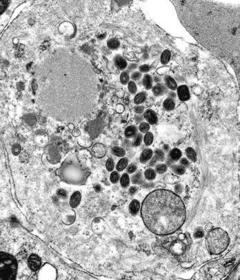 天花病毒的传播历史