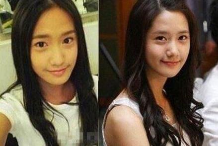 林允儿整容前后的图片