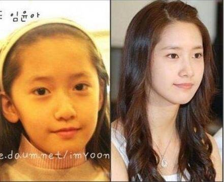 林允儿整容前后的图片