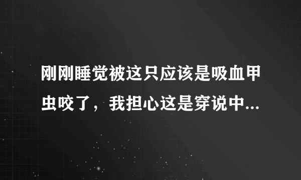 刚刚睡觉被这只应该是吸血甲虫咬了，我担心这是穿说中的螨虫，所以求专家看下这是什么虫，有无危害