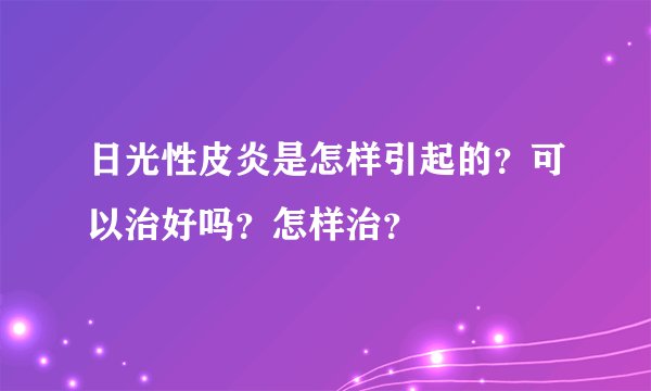 日光性皮炎是怎样引起的？可以治好吗？怎样治？
