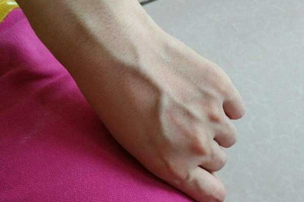 青筋是人体一个正常的脉络，生活中手背青筋暴起的原因有哪些？