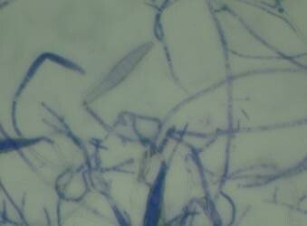 狗狗皮肤病怎么治？