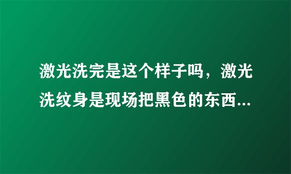 激光洗完是这个样子吗，激光洗纹身是现场把黑色的东西击碎慢慢吸收还是直接就打碎没有了。