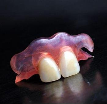 半活动义齿是什么样的，价格？