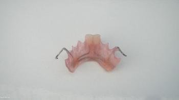 半活动义齿是什么样的，价格？